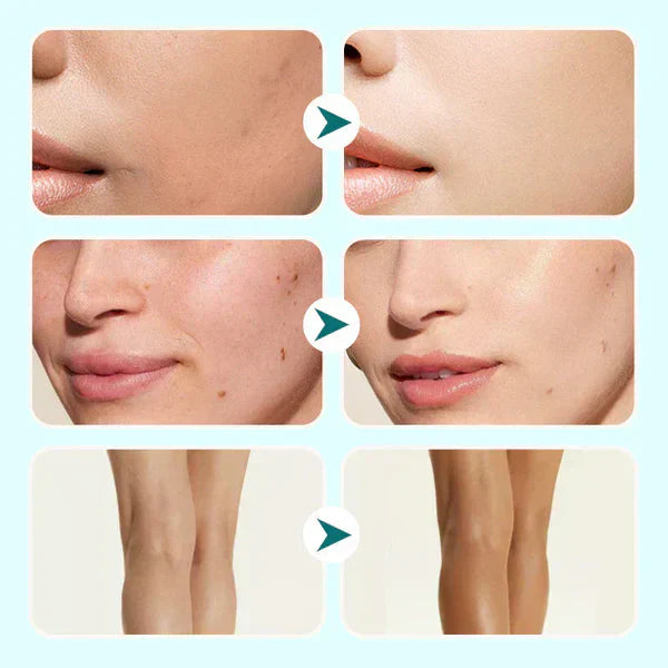 🔥Laatste dag-koop 1 krijg 1 gratis!🎁Alles-in-één moisturizer, concealer en dekking 💧✨ Lichtgewicht en waterproof